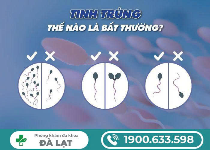 Hình ảnh minh họa
